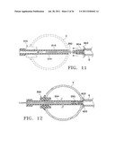 Apparatus and Methods for Anastomosis diagram and image