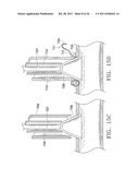 Apparatus and Methods for Anastomosis diagram and image