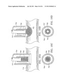 Apparatus and Methods for Anastomosis diagram and image