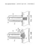 Apparatus and Methods for Anastomosis diagram and image