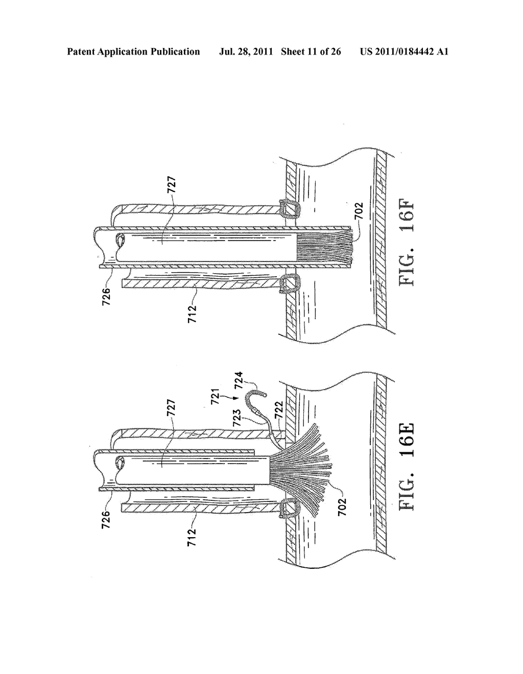 Apparatus and Methods for Anastomosis - diagram, schematic, and image 12