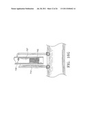 Apparatus and Methods for Anastomosis diagram and image