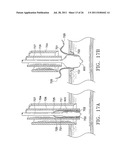 Apparatus and Methods for Anastomosis diagram and image