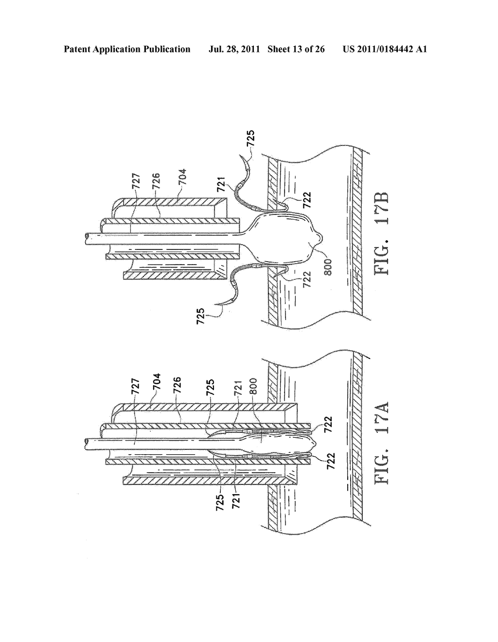 Apparatus and Methods for Anastomosis - diagram, schematic, and image 14