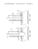 Apparatus and Methods for Anastomosis diagram and image