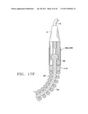 Apparatus and Methods for Anastomosis diagram and image