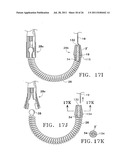 Apparatus and Methods for Anastomosis diagram and image