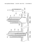 Apparatus and Methods for Anastomosis diagram and image