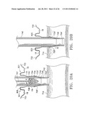 Apparatus and Methods for Anastomosis diagram and image