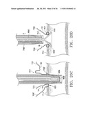 Apparatus and Methods for Anastomosis diagram and image