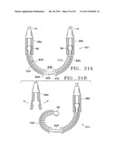 Apparatus and Methods for Anastomosis diagram and image