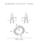 Apparatus and Methods for Anastomosis diagram and image