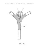 VASCULAR REMODELING DEVICE diagram and image