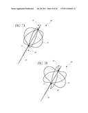 VASCULAR REMODELING DEVICE diagram and image