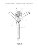 VASCULAR REMODELING DEVICE diagram and image