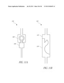 VASCULAR REMODELING DEVICE diagram and image