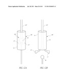 VASCULAR REMODELING DEVICE diagram and image