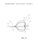 VASCULAR REMODELING DEVICE diagram and image