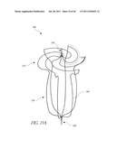 VASCULAR REMODELING DEVICE diagram and image