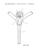 VASCULAR REMODELING DEVICE diagram and image