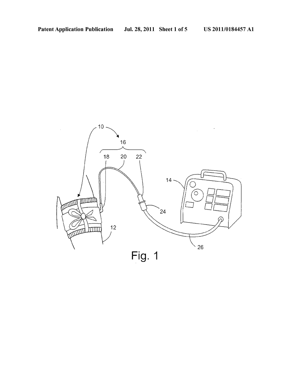 Manufacture and Use of Tourniquet Cuff with Improved Pneumatic Passageway - diagram, schematic, and image 02