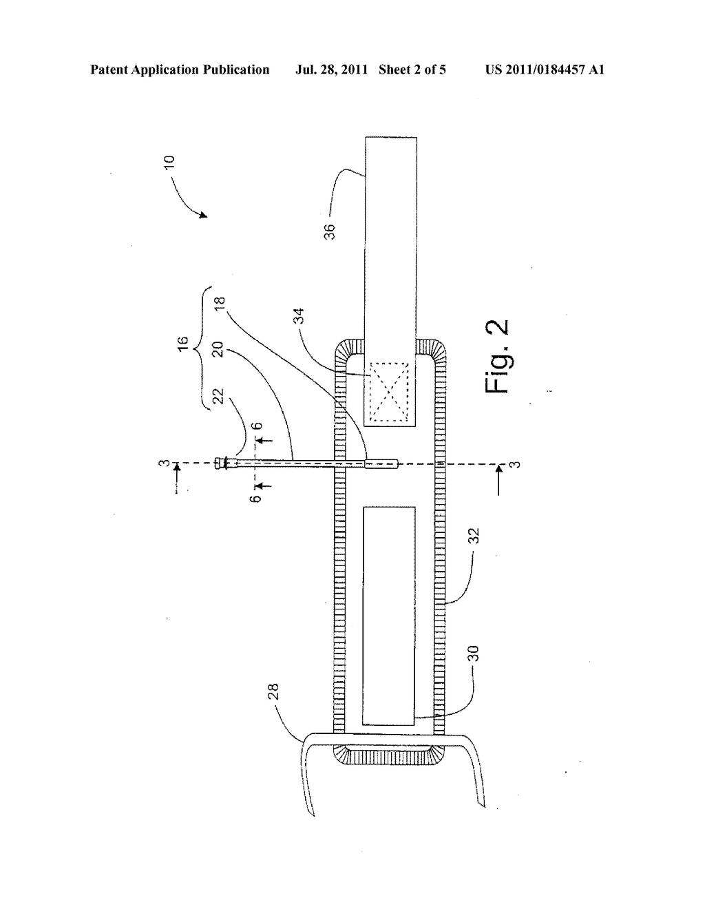 Manufacture and Use of Tourniquet Cuff with Improved Pneumatic Passageway - diagram, schematic, and image 03