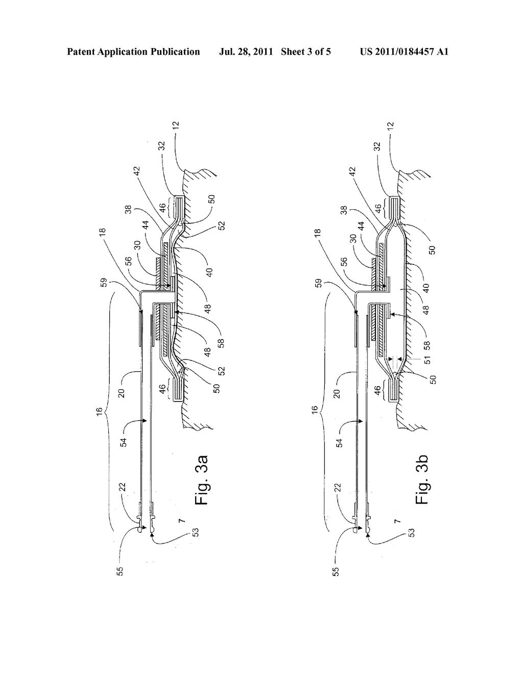 Manufacture and Use of Tourniquet Cuff with Improved Pneumatic Passageway - diagram, schematic, and image 04