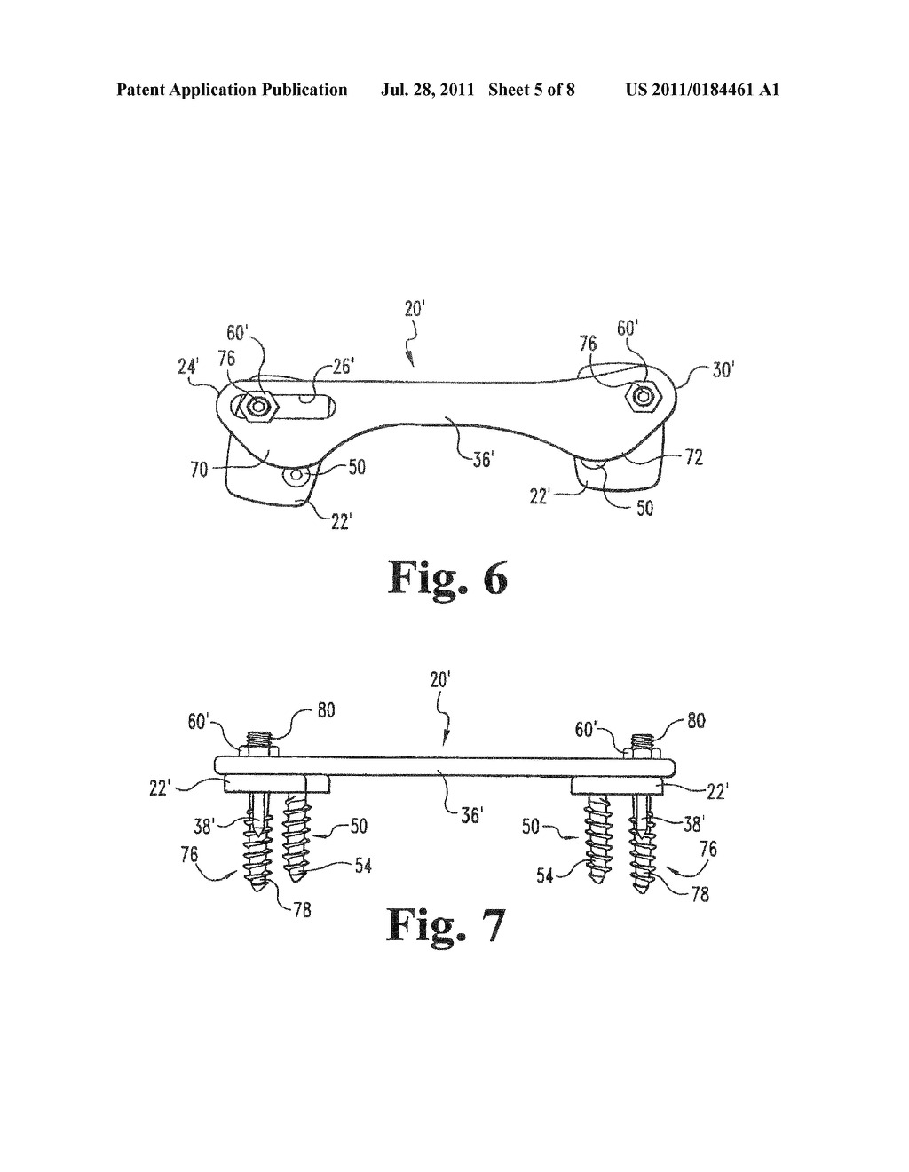 VARIABLE ANGLE ADAPTIVE PLATE - diagram, schematic, and image 06