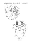 VERTEBRAL ROD CONNECTOR AND METHODS OF USE diagram and image