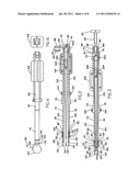 FEMORAL RING LOADER diagram and image