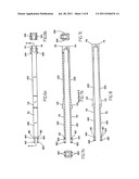 FEMORAL RING LOADER diagram and image