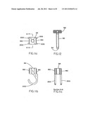 FEMORAL RING LOADER diagram and image