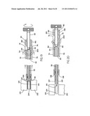 FEMORAL RING LOADER diagram and image