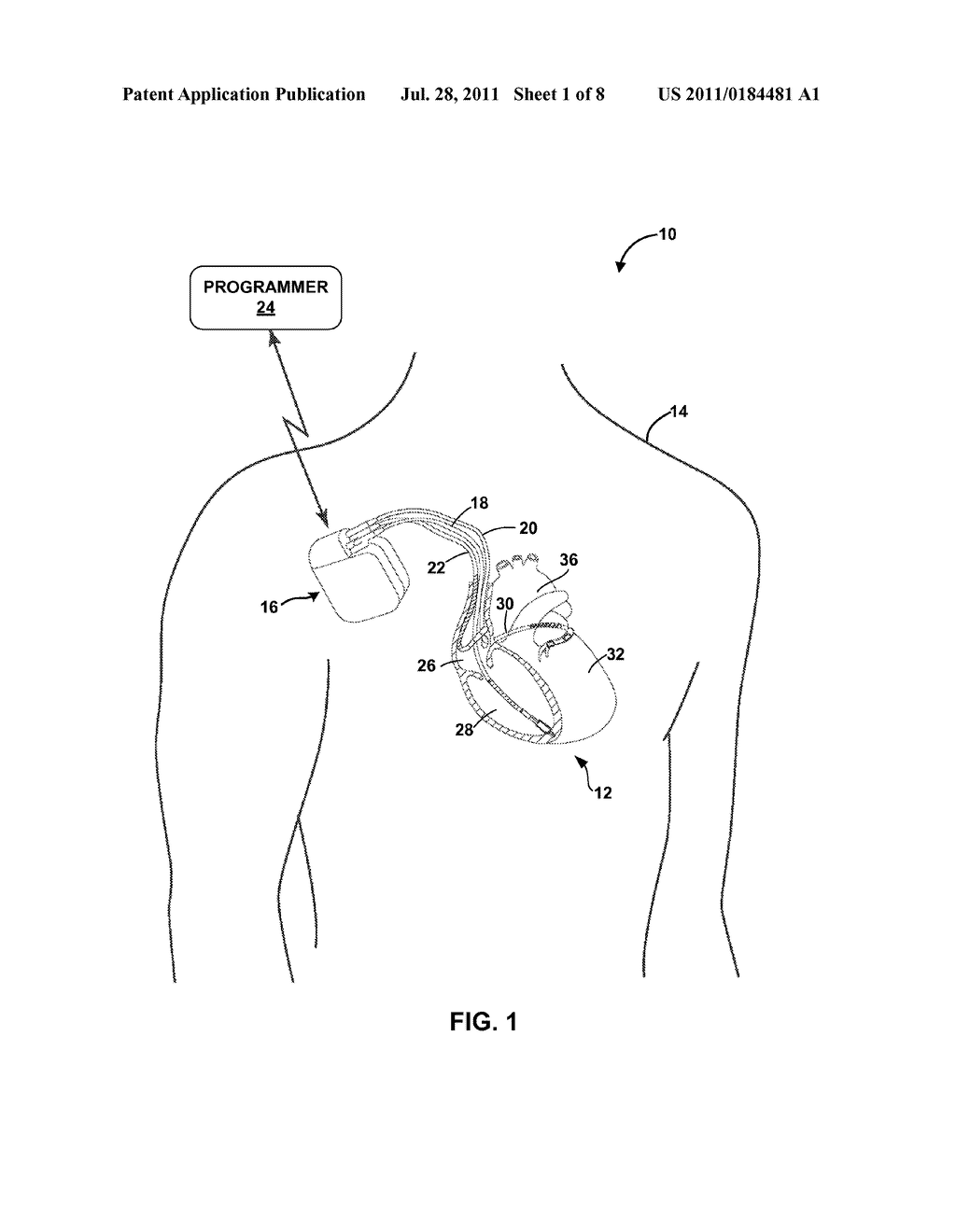 STORAGE OF DATA FOR EVALUATION OF LEAD INTEGRITY - diagram, schematic, and image 02