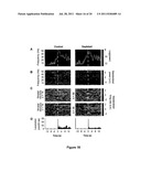 METHOD OF TREATING PARKINSON S DISEASE AND OTHER MOVEMENT DISORDERS diagram and image