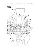 Knee joint endoprosthesis diagram and image