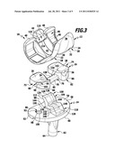 Knee joint endoprosthesis diagram and image