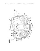 Knee joint endoprosthesis diagram and image