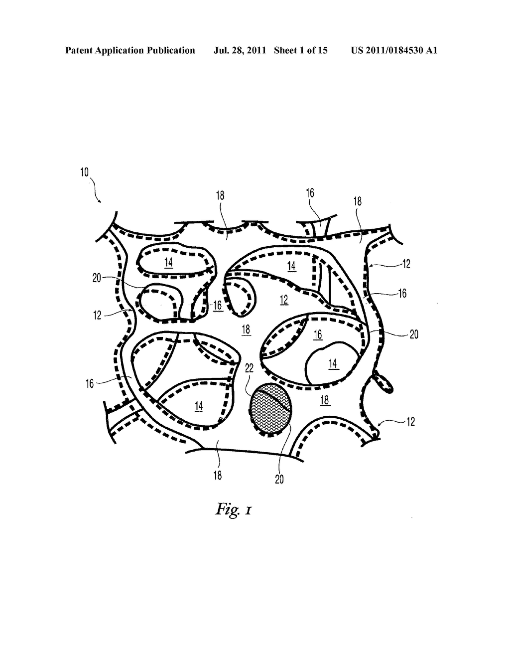 High performance reticulated elastomeric matrix preparation, properties,     reinforcement, and use in surgical devices, tissue augmentation and/or     tissue repair - diagram, schematic, and image 02