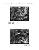 OPEN CELLED FOAMS, IMPLANTS INCLUDING THEM AND PROCESSES FOR MAKING SAME diagram and image