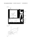 VIRTUAL ENDOSCOPY APPARATUS, METHOD FOR DRIVING THEREOF AND MEDICAL     EXAMINATION APPARATUS diagram and image