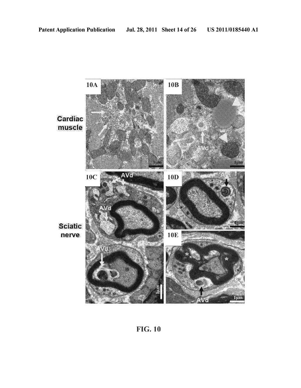 CISD2-Knockout Mice and Uses Thereof - diagram, schematic, and image 15