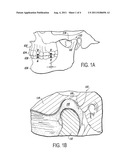 BIRTHING AID:  METHOD OF USING MUSCULOSKELETAL REPOSITIONING DEVICE diagram and image