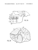 BIRTHING AID:  METHOD OF USING MUSCULOSKELETAL REPOSITIONING DEVICE diagram and image