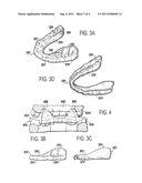 BIRTHING AID:  METHOD OF USING MUSCULOSKELETAL REPOSITIONING DEVICE diagram and image