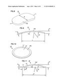 NASAL VALVE TREATMENT METHOD & APPARATUS diagram and image