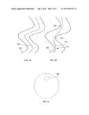 SYSTEM AND METHOD FOR VIRTUALLY AUGMENTED ENDOSCOPY diagram and image