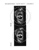 CT Image Reconstruction In The Extended Field Of View diagram and image