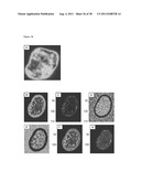 METHODS OF GENERATING TROPHECTODERM AND NEURECTODERM FROM HUMAN EMBRYONIC     STEM CELLS diagram and image