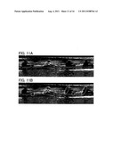 ENCODING METHOD, ENCODING DEVICE, AND ENCODING PROGRAM FOR ENCODING     INTERLACED IMAGE diagram and image